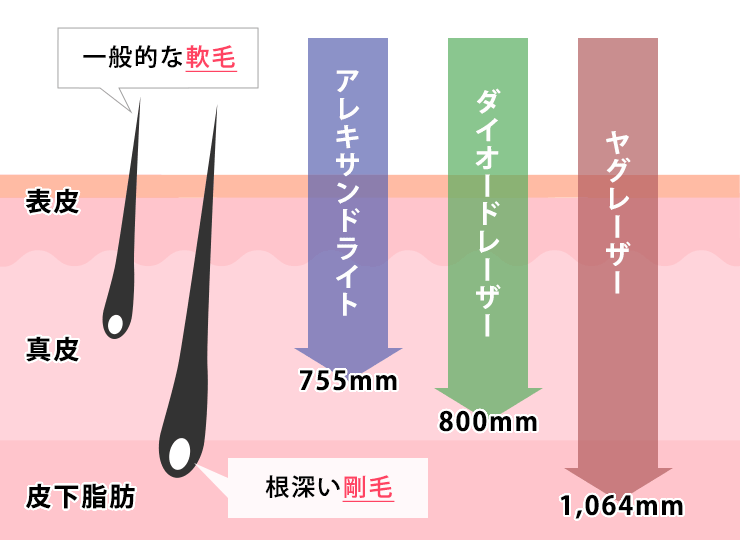 波長の違い