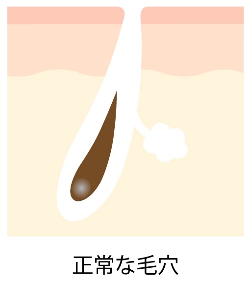 正常な毛穴