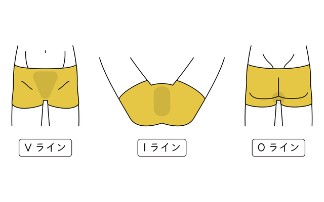 メンズVIO脱毛