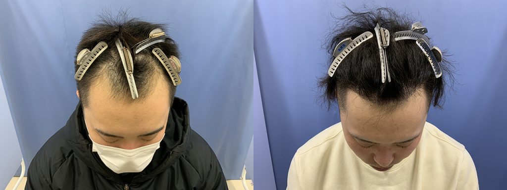 アイランドタワークリニック症例写真1